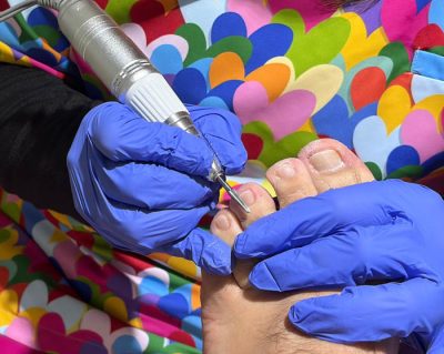 Podóloga Podología Geriátrica en Estepona